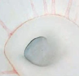 汚れが少々ある ピンク色の『スジ状』の汚れ | お手入れ・点検 | お客様サポート